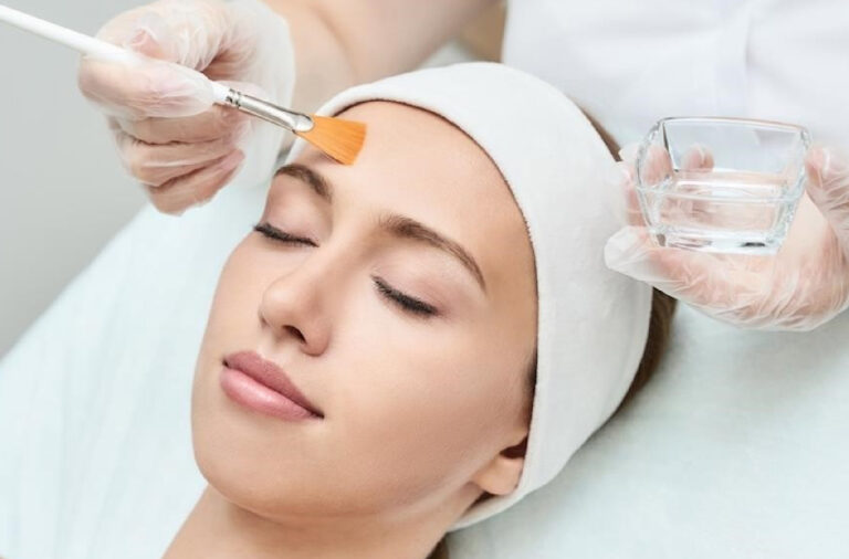 Chemical Peels treatment