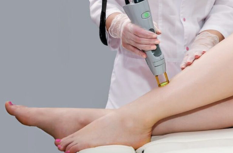 Laser treatments